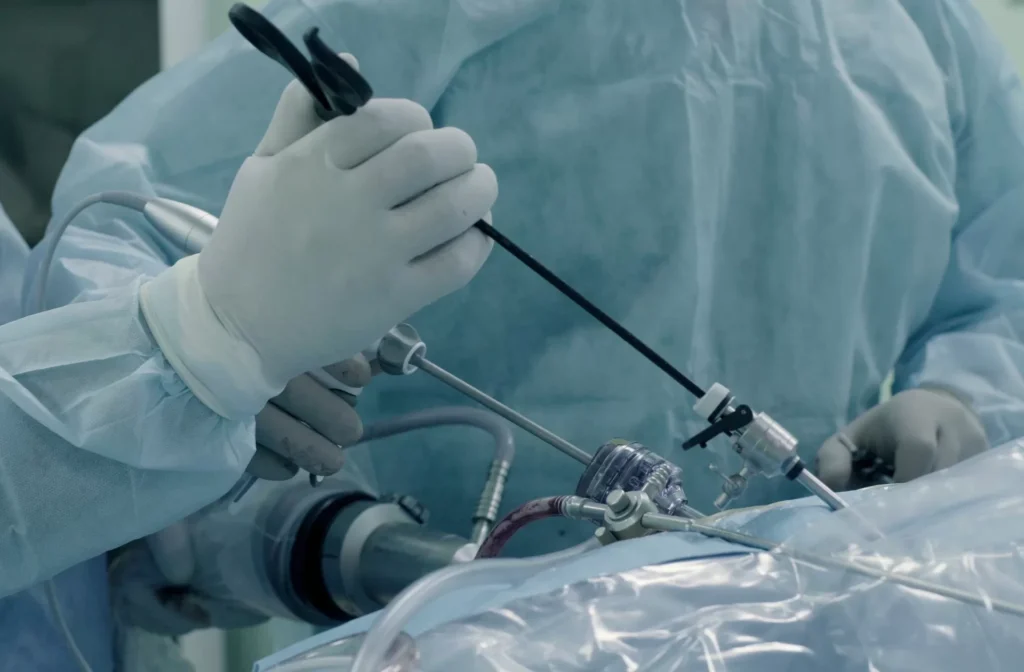 General & Laparoscopic Surgery