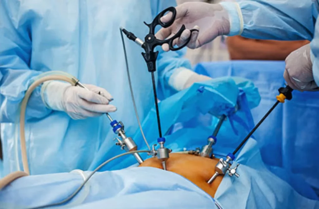Surgical Gastroenterology Services