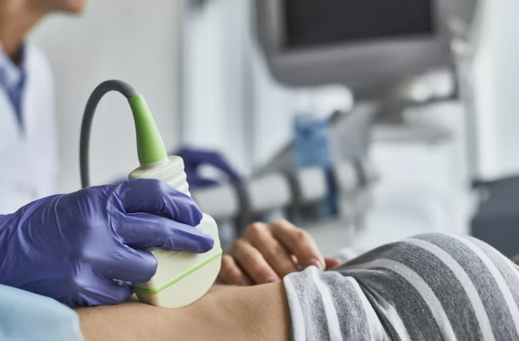 3D/4D Color Doppler Ultra Sonography