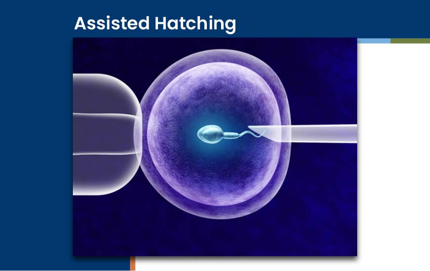 assisted-hatching