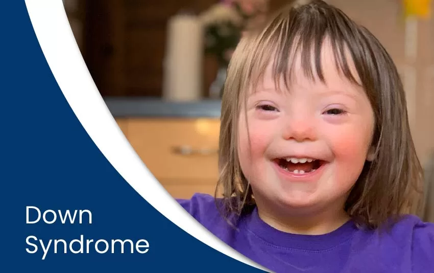 down-syndrome-jpg