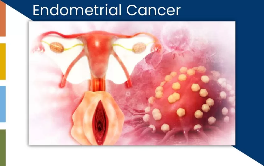 endometrial-cancer-jpg