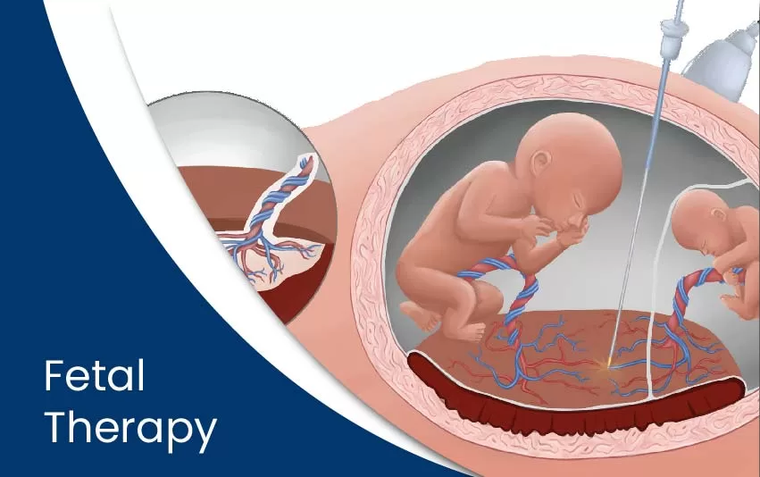 fetal-therapy-jpg