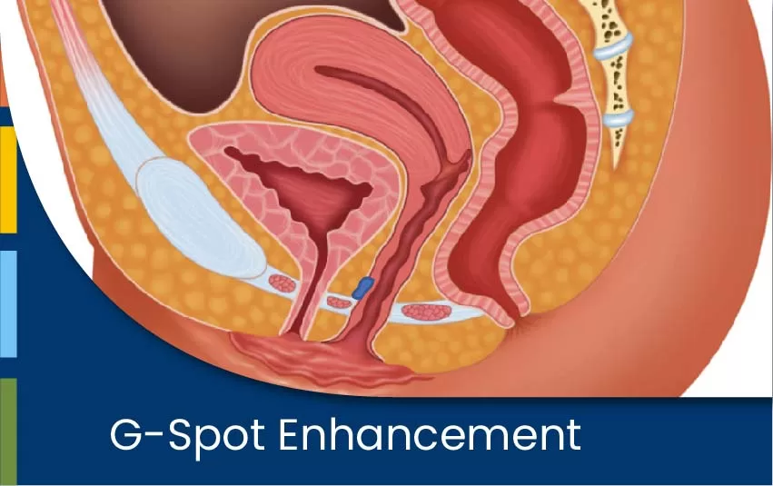 g-spot-enhancement-jpg
