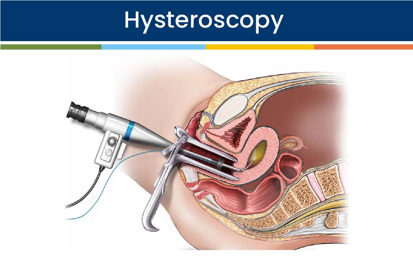 Hysteroscopy