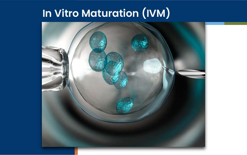in-vitro-maturation-ivm (1)