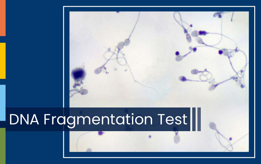 DNA FRAGMENTATION TEST