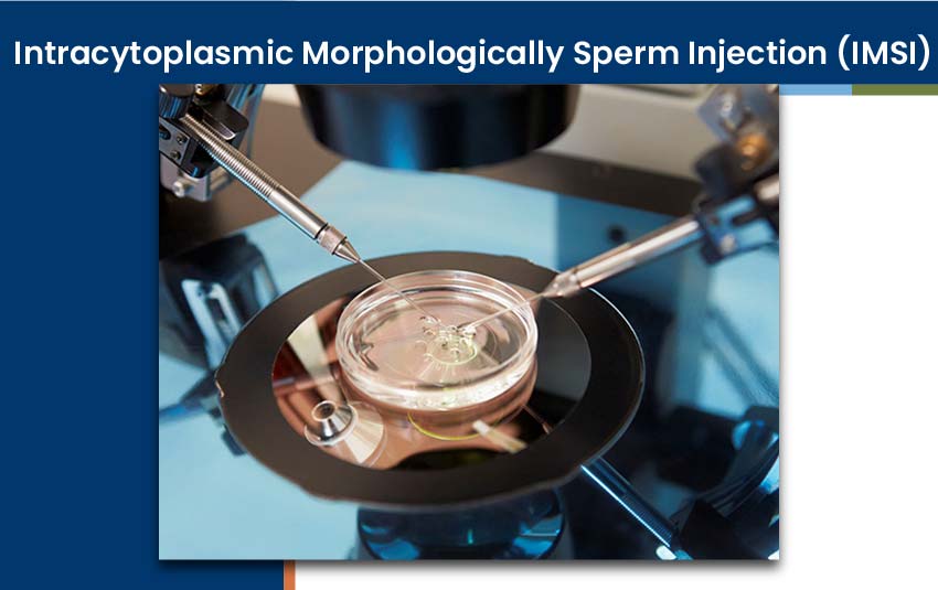 intracytoplasmic-morphologically-sperm-injection-imsi