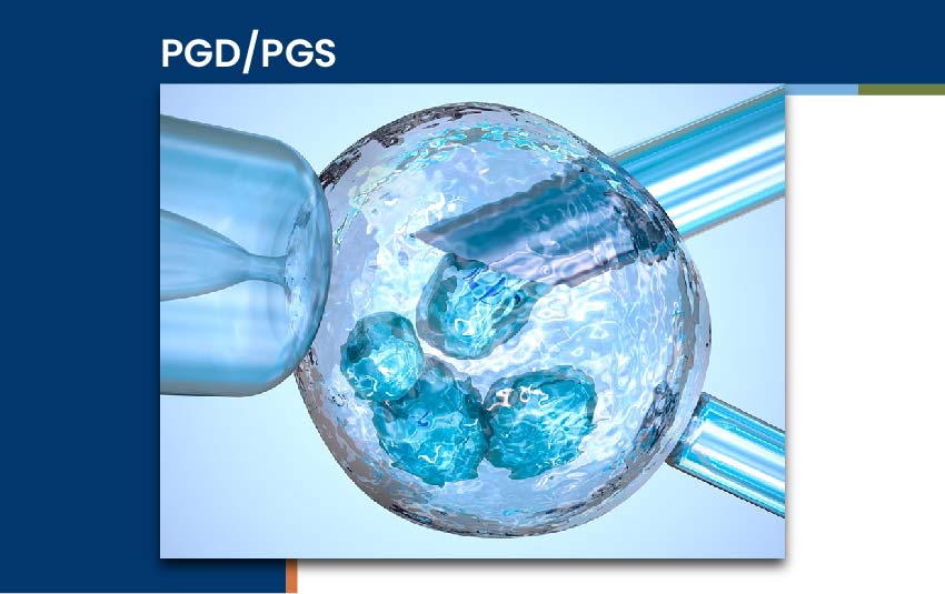 pgdpgs