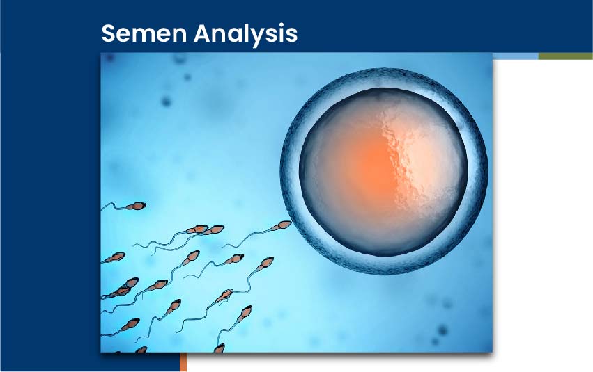 semen-analysis